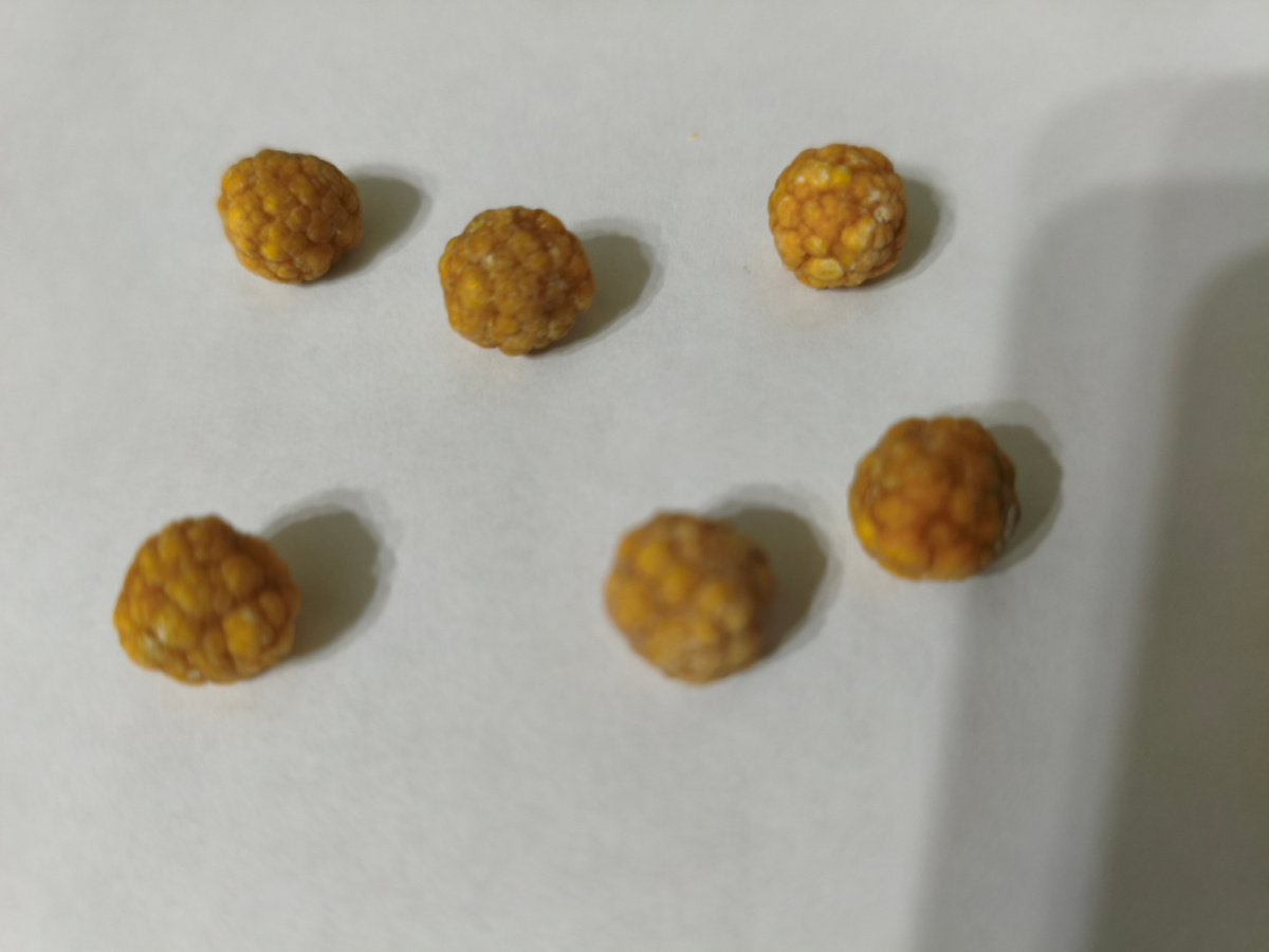 Резкое вмешательство: как удаление желчного пузыря изменило жизнь одной женщины